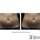 Chicago-cosmetic-surgery-and-dermatology-5240580-featured